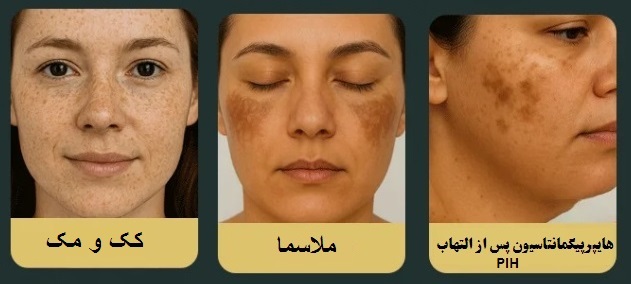 آشنایی با انواع رنگدانه ها