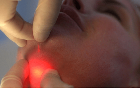 عوارض جانبی اندولیفت چیست؟